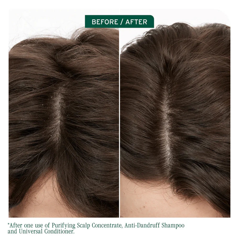 Load image into Gallery viewer, Matrix Biolage Scalp Sync Anti Dandruff Shampoo &amp; Universal Conditioner 1 Litre Duo
