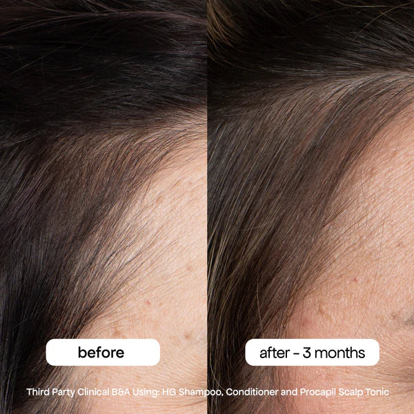 Load image into Gallery viewer, BondiBoost HG Conditioner 300ml
