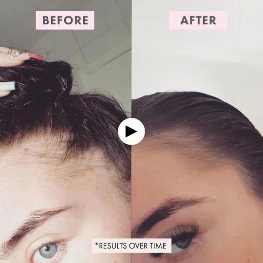 Load image into Gallery viewer, BondiBoost Intensive Growth Spray 125ml

