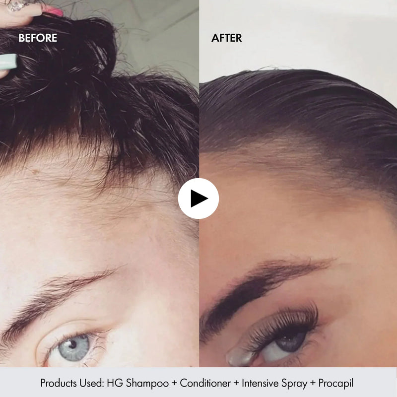 Load image into Gallery viewer, BondiBoost Procapil Hair Tonic 125ml
