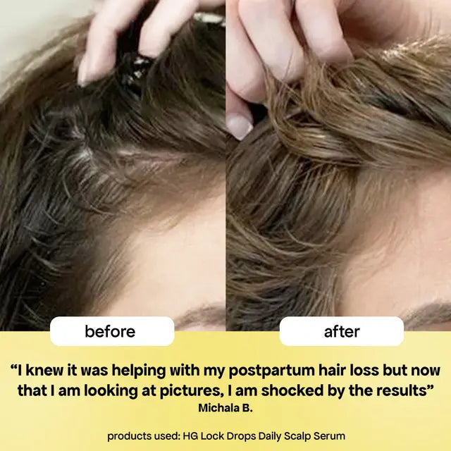 Load image into Gallery viewer, Bondi Boost Lock Drops Anti Shedding Scalp and Hair Serum 30ml
