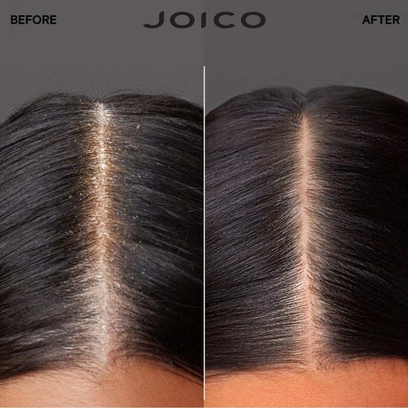 Load image into Gallery viewer, Joico Scalp Vitality Duo

