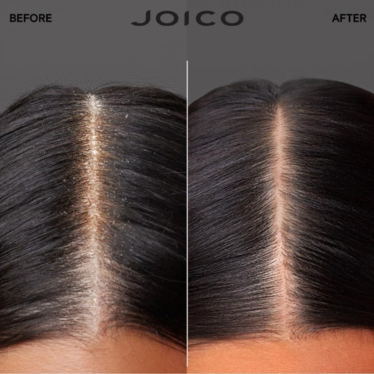 Joico Scalp Vitality Duo