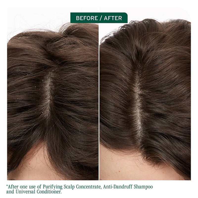 Load image into Gallery viewer, Matrix Biolage Scalp sync Anti-Dandruff Shampoo 400ml
