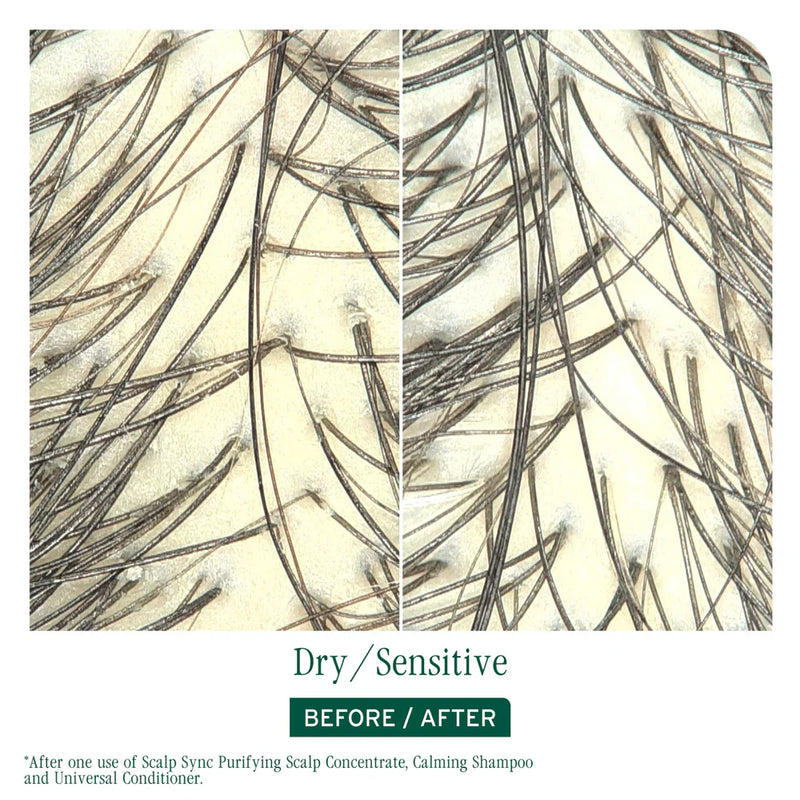 Load image into Gallery viewer, Matrix Biolage Scalp Sync Calming Shampoo 1 Litre
