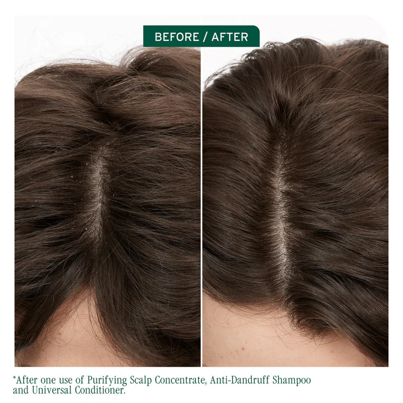 Load image into Gallery viewer, Matrix Biolage Scalp Sync Universal Conditioner 1 Litre
