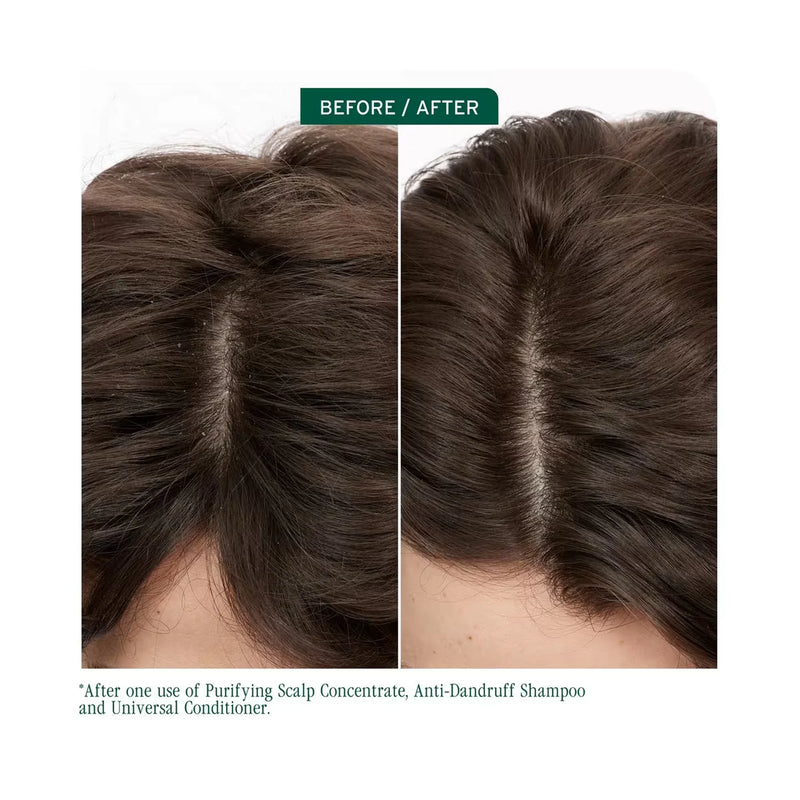 Load image into Gallery viewer, Matrix Biolage Scalp Sync Anti-Dandruff Shampoo &amp; Universal Conditioner Duo
