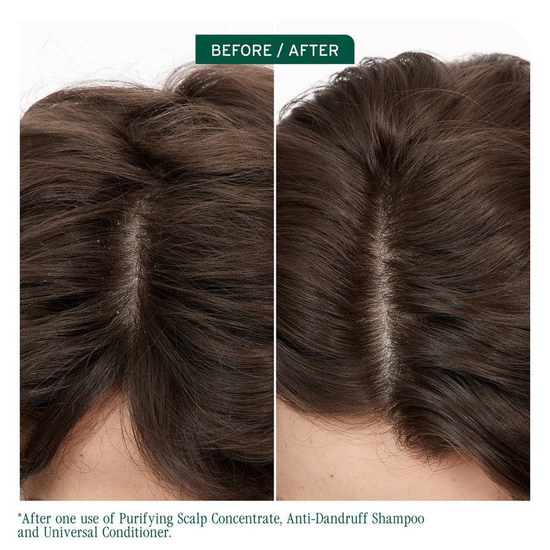 Load image into Gallery viewer, Matrix Biolage Scalp Sync Dandruff Prone Scalp Care Trio Bundle
