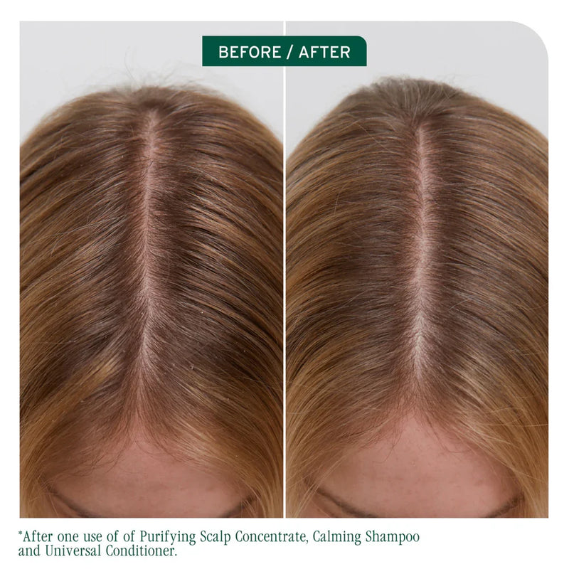 Load image into Gallery viewer, Matrix Biolage Scalp Sync Calming Shampoo &amp; Universal Conditioner 1 Litre Duo
